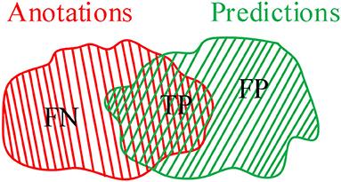 Automatic Segmentation of Novel Coronavirus Pneumonia Lesions in CT Images Utilizing Deep-Supervised Ensemble Learning Network